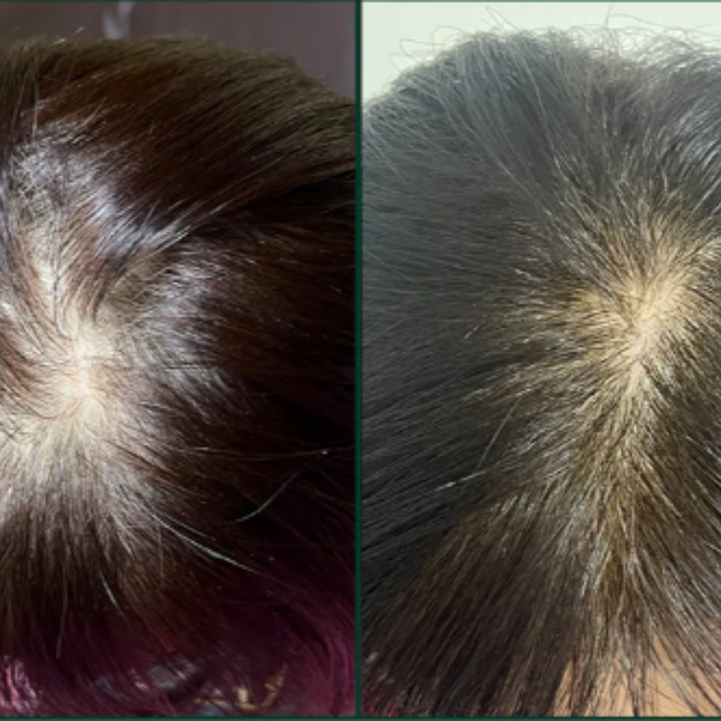 Zentora™ - Hair Growth Scalp Ampoule